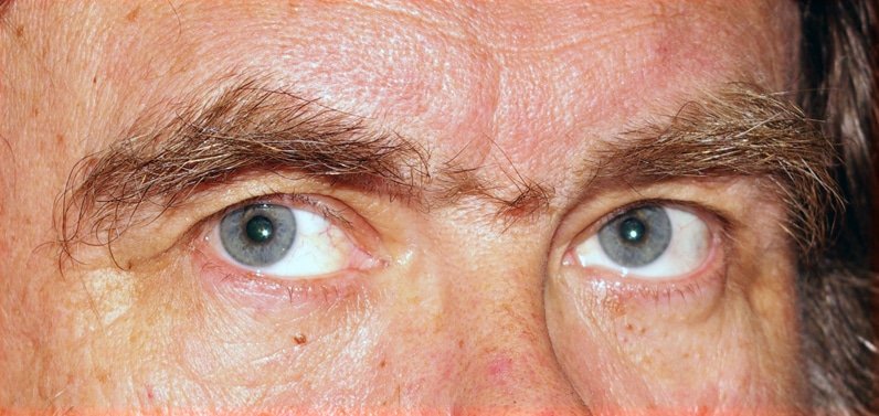 Be My Eyes