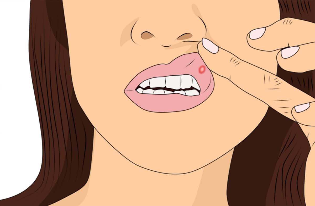 Co może być przyczyną powstawania owrzodzeń w jamie ustnej?