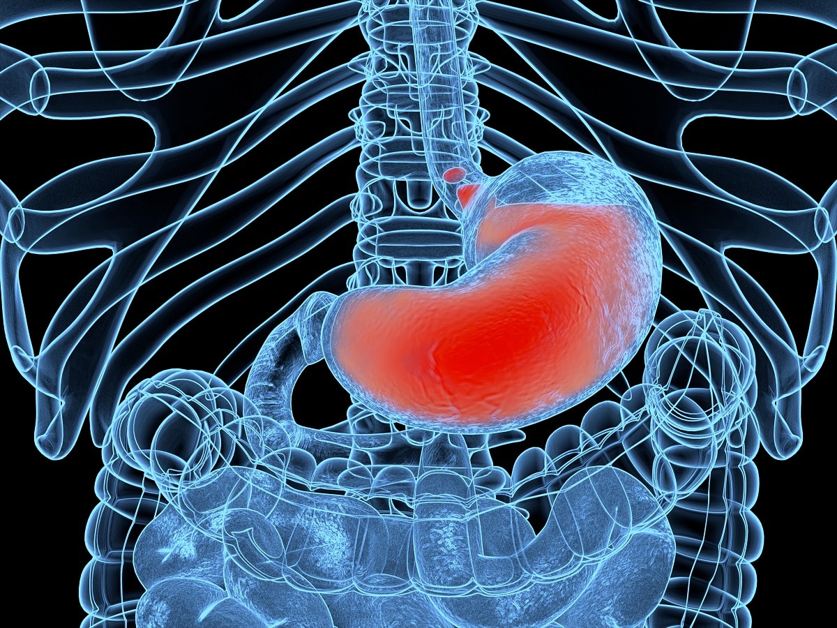 Czym jest refluks żołądkowo-przełykowy i jakie są metody leczenia?